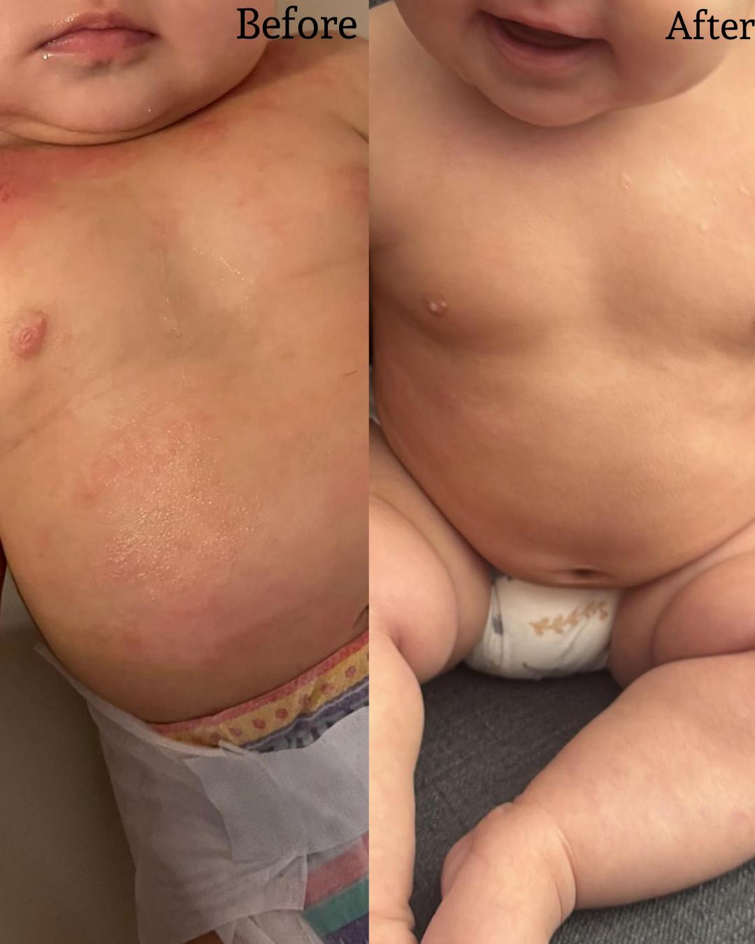 Oat & Honey soap (Eczema Safe)